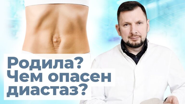 Послеродовый диастаз опаснее чем вы думаете | Диастаз и его степени