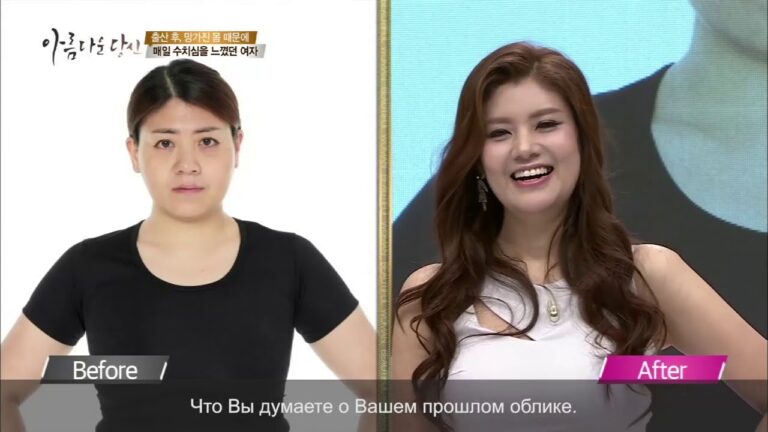 Пластическая хирургия в Корее Проэкт "Вы прекрасны"  Второй шанс для многодетной мамы Клиника JK