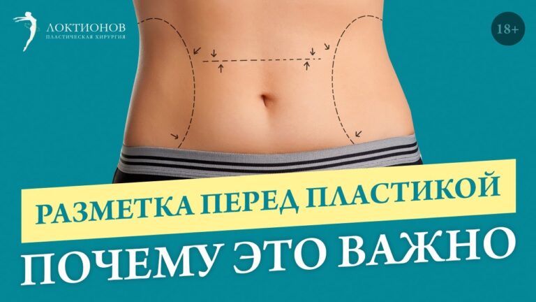 От этого зависит результат пластики // Пластическая операция и разметка // 18+