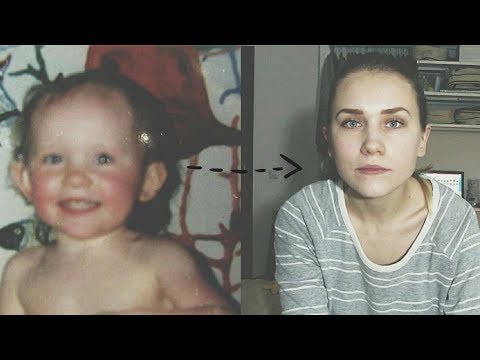 Моя ПЛАСТИЧЕСКАЯ операция — OLESYA TUGI
