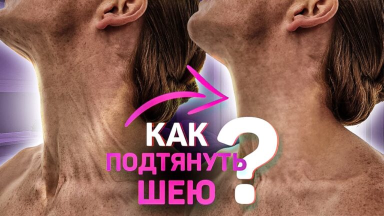 Как подтянуть шею? Ботокс в шею и упражнения.