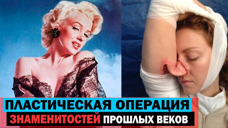 Экстремальная пластическая хирургия в Голливуде: первый опыт знаменитостей