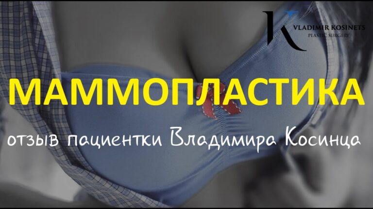 Через 3 часа после увеличения груди имплантами — Отзыв пациентки Владимира Косинца
