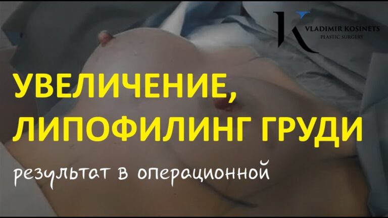 Увеличение, липофилинг молочных желез — хирург Владимир Косинец