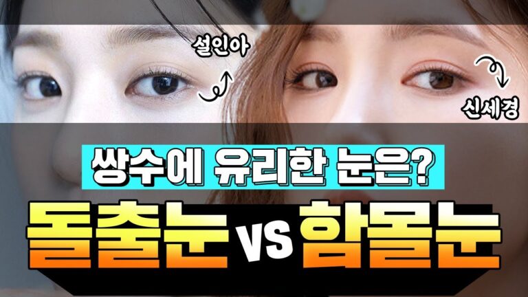 돌출눈 쌍수, 함몰눈 쌍수 더 유리한 눈은? | 사내맞선 설인아 쌍꺼풀, 신세경 쌍꺼풀처럼 수술하고 싶다면? | 디에이성형외과