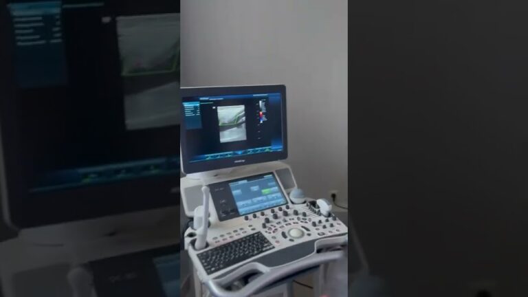 Проведем УЗИ нижних конечностей быстро и качественно