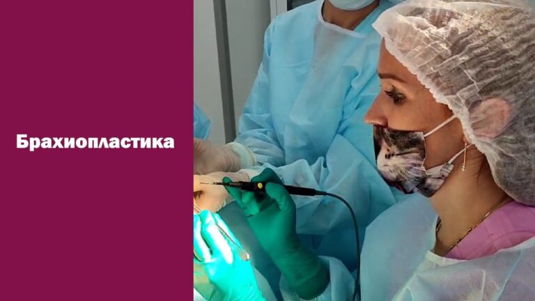 Пластика рук: брахиопластика. Пластический хирург Константинова И.В.