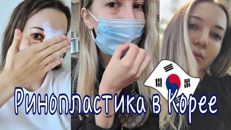 ПЛАСТИЧЕСКАЯ ОПЕРАЦИЯ В ЮЖНОЙ КОРЕЕ. Ринопластика. Моя реабилитация. #кореявлог #жизньвкорее #корея