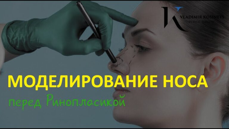 КТО ДОЛЖЕН МОДЕЛИРОВАТЬ НОС ПЕРЕД РИНОПЛАСТИКОЙ — хирург Владимир Косинец